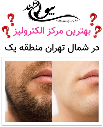 بهترین مرکز الکترولیز در شمال تهران منطقه یک