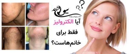 آیا الکترولیز فقط برای خانم‌هاست؟ تجربه مردانه