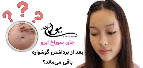جای سوراخ ابرو بعد از برداشتن گوشواره باقی میماند؟