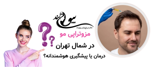 مزوتراپی صورت در شمال تهران مزوتراپی مو در شمال تهران؛ درمان یا پیشگیری هوشمندانه؟