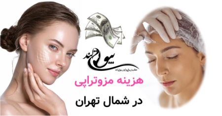 مزوتراپی صورت در شمال تهران هزینه مزوتراپی در شمال تهران چرا متفاوت است؟