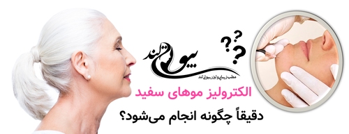 الکترولیز موهای سفید دقیقاً چگونه انجام میشود؟