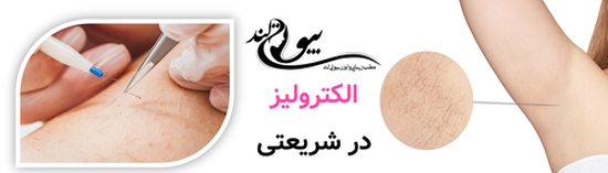 الکترولیز در شریعتی