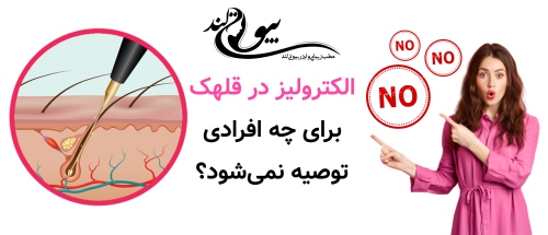 الکترولیز در قلهک برای چه افرادی توصیه نمی‌شود؟