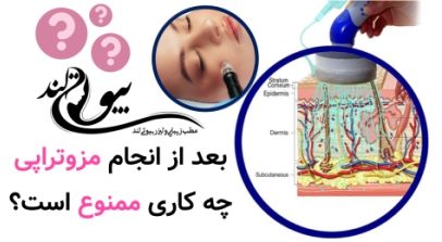 بعد از انجام مزوتراپی چه کاری ممنوع است؟