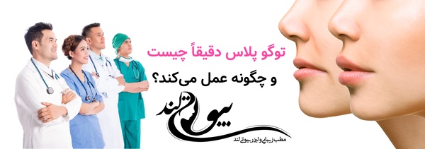 توگو پلاس دقیقاً چیست و چگونه عمل میکند؟