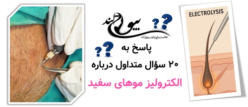 پاسخ به ۲۰ سؤال متداول درباره الکترولیز موهای سفید