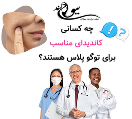 چه کسانی کاندیدای مناسب برای توگو پلاس هستند؟