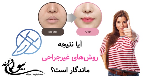 آیا نتیجه روشهای غیرجراحی مثل نخ یا بوتاکس ماندگار است؟
