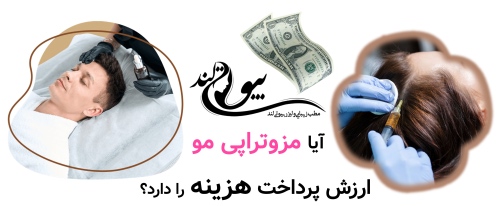 هزینه مزوتراپی مو | واقعاً چقدر باید برای درمان ریزش مو پرداخت کنیم؟ آیا مزوتراپی مو ارزش پرداخت هزینه را دارد؟