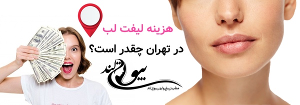 هزینه لیفت لب در تهران چقدر است؟