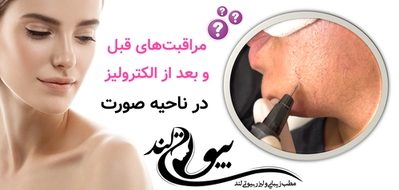 مراقبتهای قبل و بعد از الکترولیز در ناحیه صورت