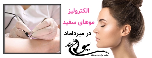 الکترولیز موهای سفید در میرداماد