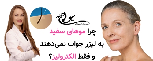 الکترولیز موهای سفید در میرداماد :چرا موهای سفید به لیزر جواب نمی‌دهند و فقط الکترولیز؟