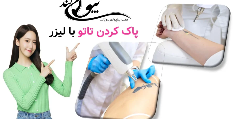 پاک کردن تاتو با لیزر