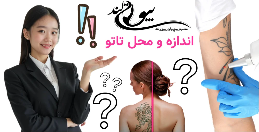 هزینه پاک کردن تاتو با لیزر در تهران اندازه و محل تاتو