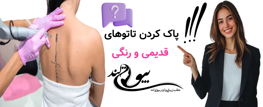 پاک کردن تاتوهای قدیمی و رنگی
