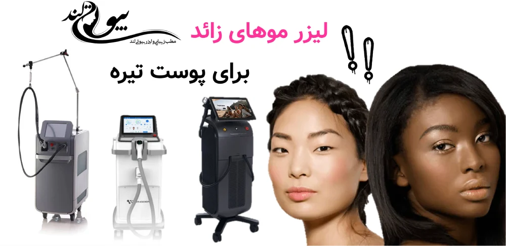 لیزر موهای زائد برای پوست تیره