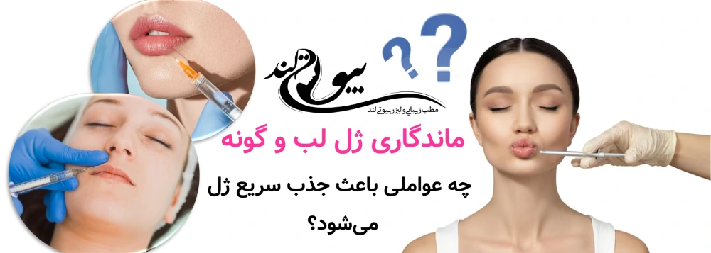 ماندگاری ژل لب و گونه؛ چه عواملی باعث جذب سریع ژل می‌شود؟