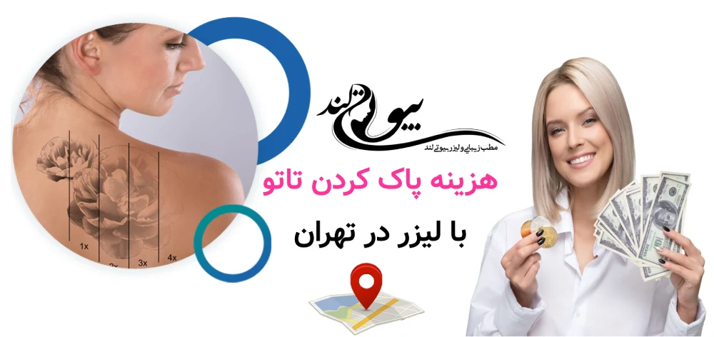 هزینه پاک کردن تاتو با لیزر در تهران