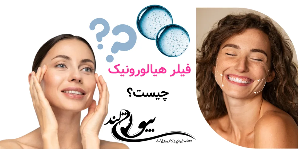 فیلر هیالورونیک چیست؟